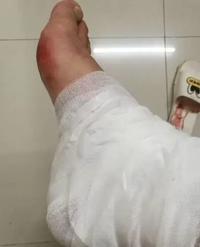 外卖小哥送餐时遇到女子受伤 毫无犹豫将其送医