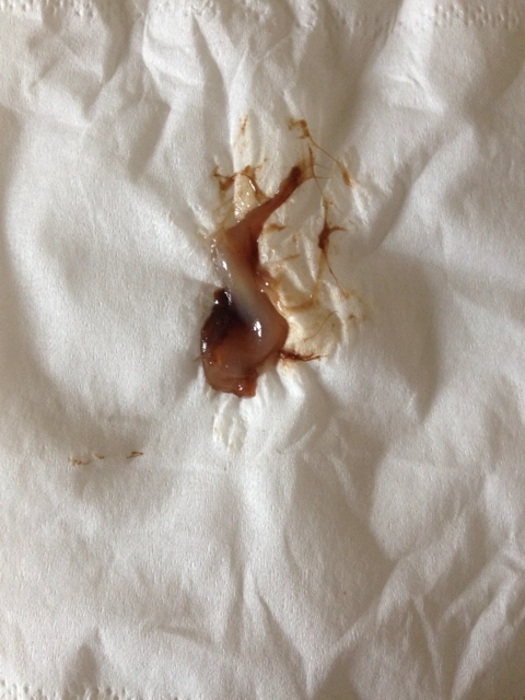 5月30日预产期,今天中午发现很多黏液,这是见红吗?