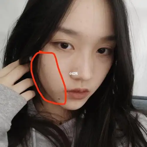 问一下脸上这条线是啥