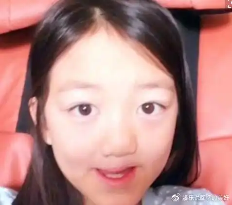 遗憾的是在李嫣出身的时分身材带有天赋性缺点,即是唇腭裂,李嫣前后伍