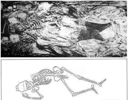 万历皇帝尸骨(图片借鉴,侵权可删)