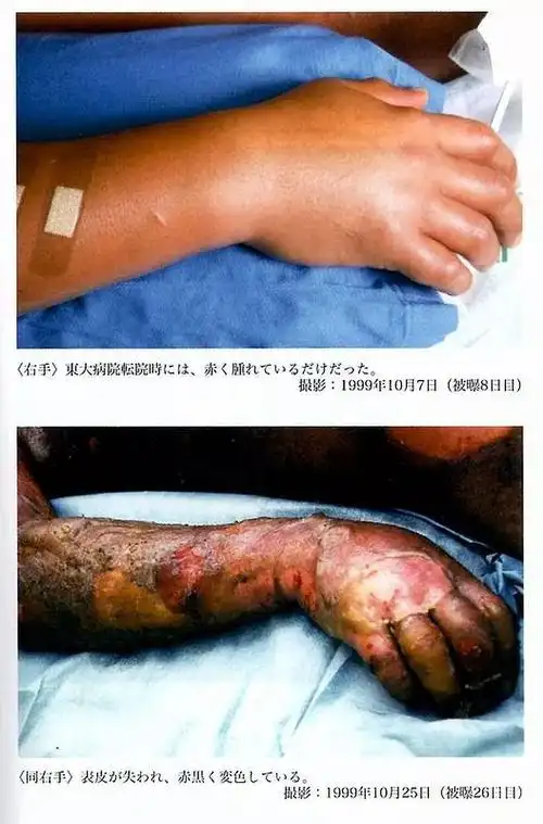 慎入科普一下东海村临界事故几乎没有什么怪谈能和这相比