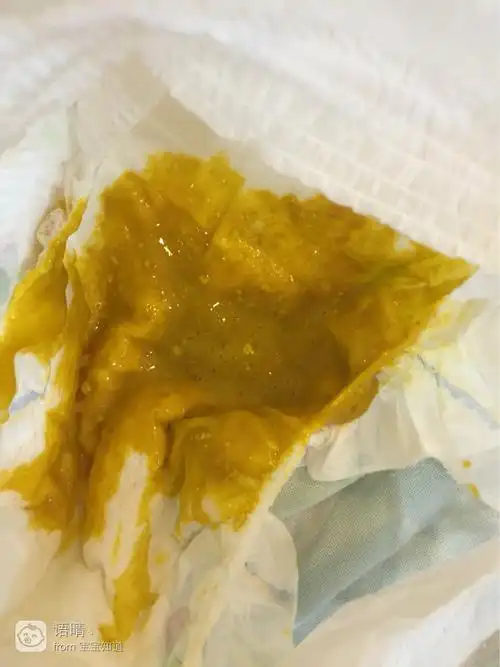 急急急,宝宝一个月零15天拉粑粑又多又稀,有经验的宝妈帮我看看是什么