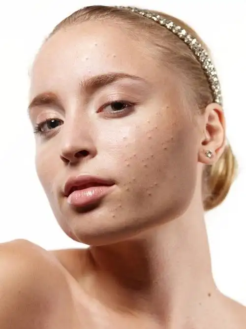 ps人像精修处理—粗糙皮肤变细腻