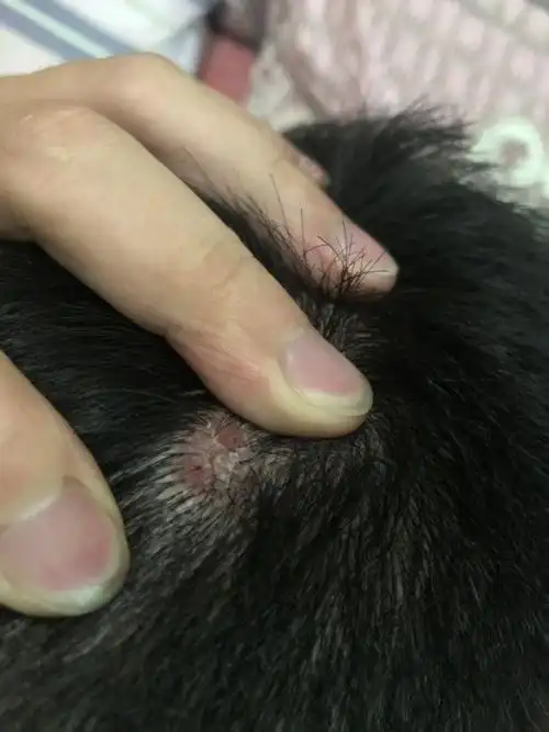 怎么才能治疗好?头上有个疙瘩特别不舒服. 怎么才能治疗好?