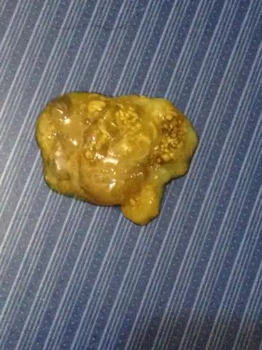 一个多月大的小狗的便便呈黄色带有油是怎么回事呢?