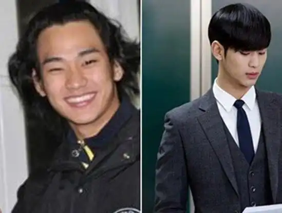 【图】拥抱太阳的月亮金秀贤自认整容 揭秘金秀贤整容前照片