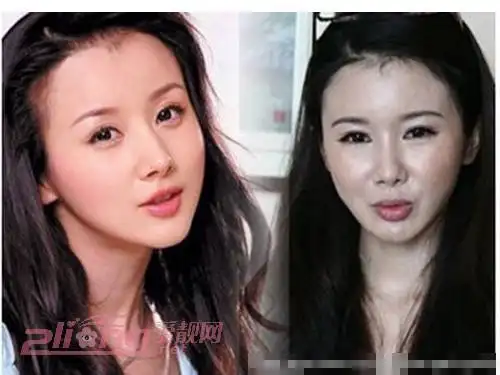 盘点整容失败的女明星,谁毁容最厉害(第2页)