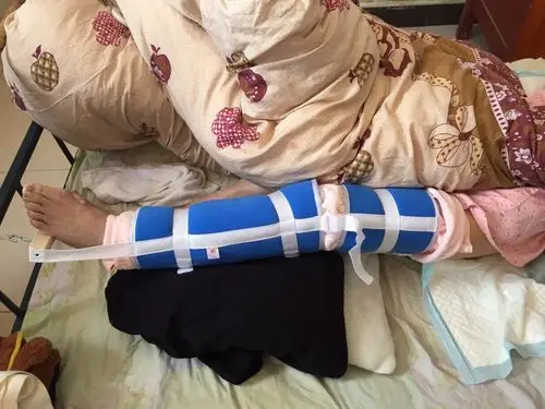 骨科2月家庭随访