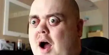 铜仁八中学生长期戴眼镜会让眼睛变形