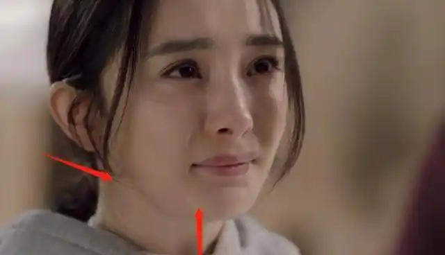 《谢谢你医生》中杨幂嘴角的黑痣,白宇的胡茬,都证明了滤镜的真实度