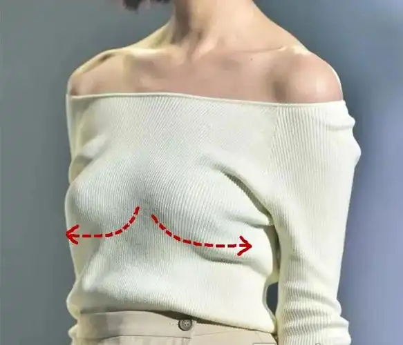 很轻易导致乳房韧带组织拉长或断裂,从而形成胸下垂,胸型外扩!