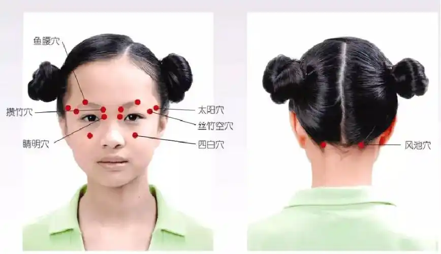 干眼症不可怕,中医教你怎么治!