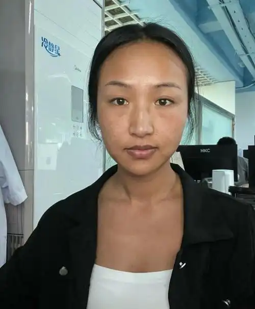 肤色不均匀暗沉