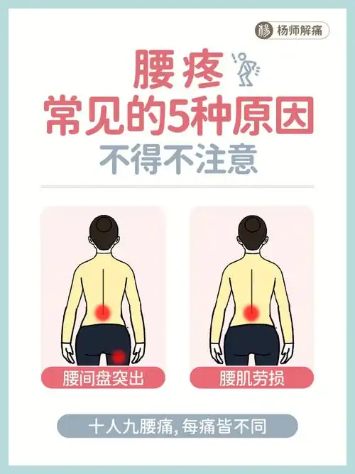 腰疼星人看过来丨常见的5种腰疼原因要注意