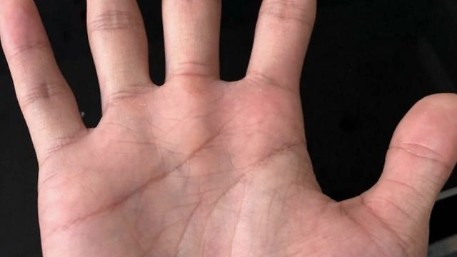 手相中元宝纹和棺材纹别傻傻分不清楚