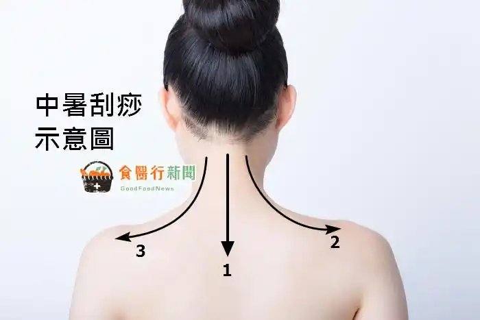 夏日防中暑!中医传授解热刮痧法 4大饮品有效散热