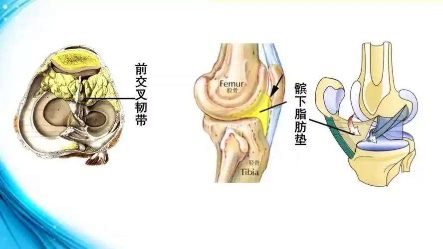 髌下脂肪垫,填充于髌骨,股骨髁下方,胫骨髁上方和髌韧带之间的区域,被