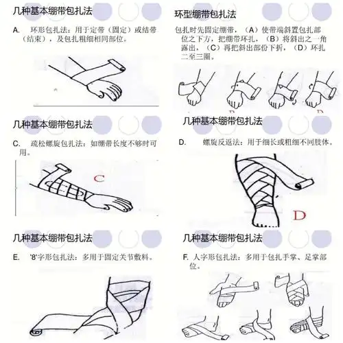 绷带包扎方法:环形包扎法,疏松螺旋包扎法,螺旋反返法,"8"字形包扎法