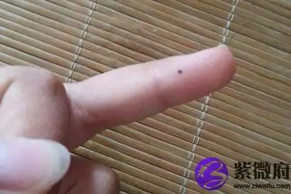 手上长痣 揭秘手上中指痣的含义
