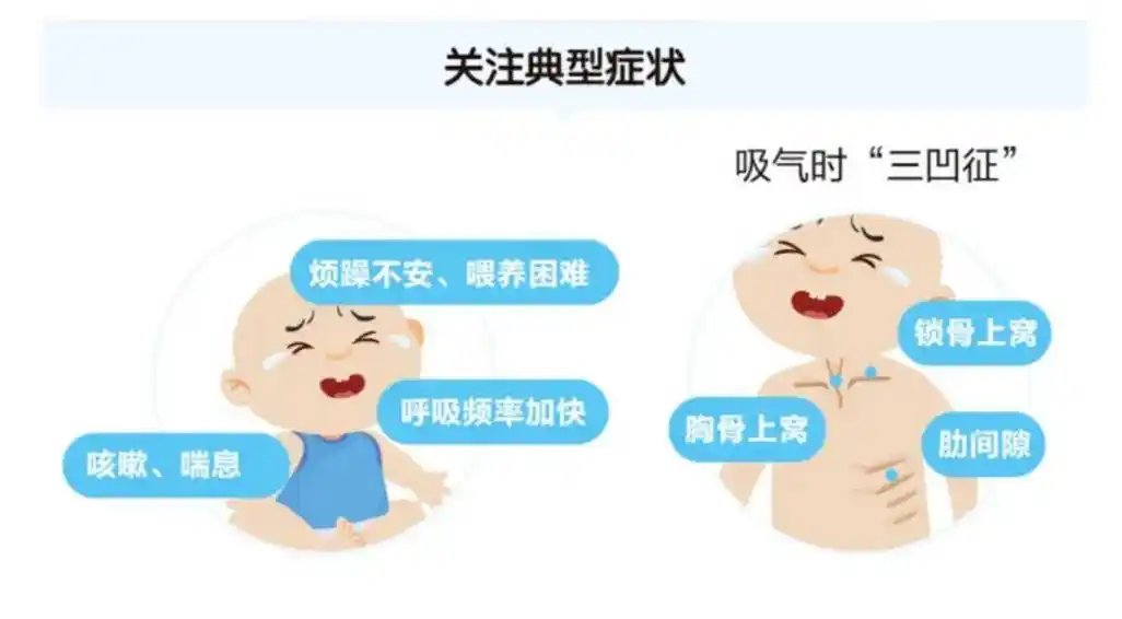 小贴士:"三凹征"是指呼吸肌为克服气道阻力极度收缩