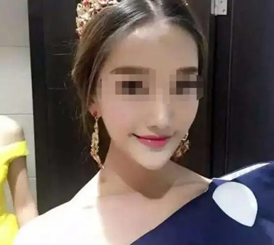 23岁美女模特遭前男友杀害生前曾被质疑整过容