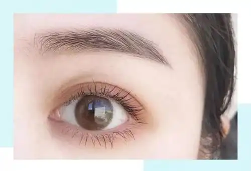 北京爱悦丽格马力:如何拥有灵动美眼?