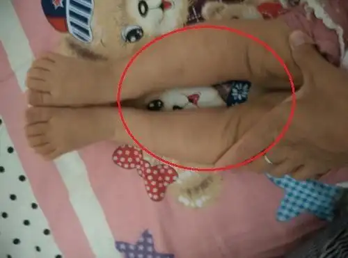 宝宝腿型正常不正常,父母可以通过这些判断