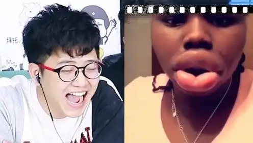 憋笑大挑战:女黑人的嘴巴肿了起来,我忍不住笑了!