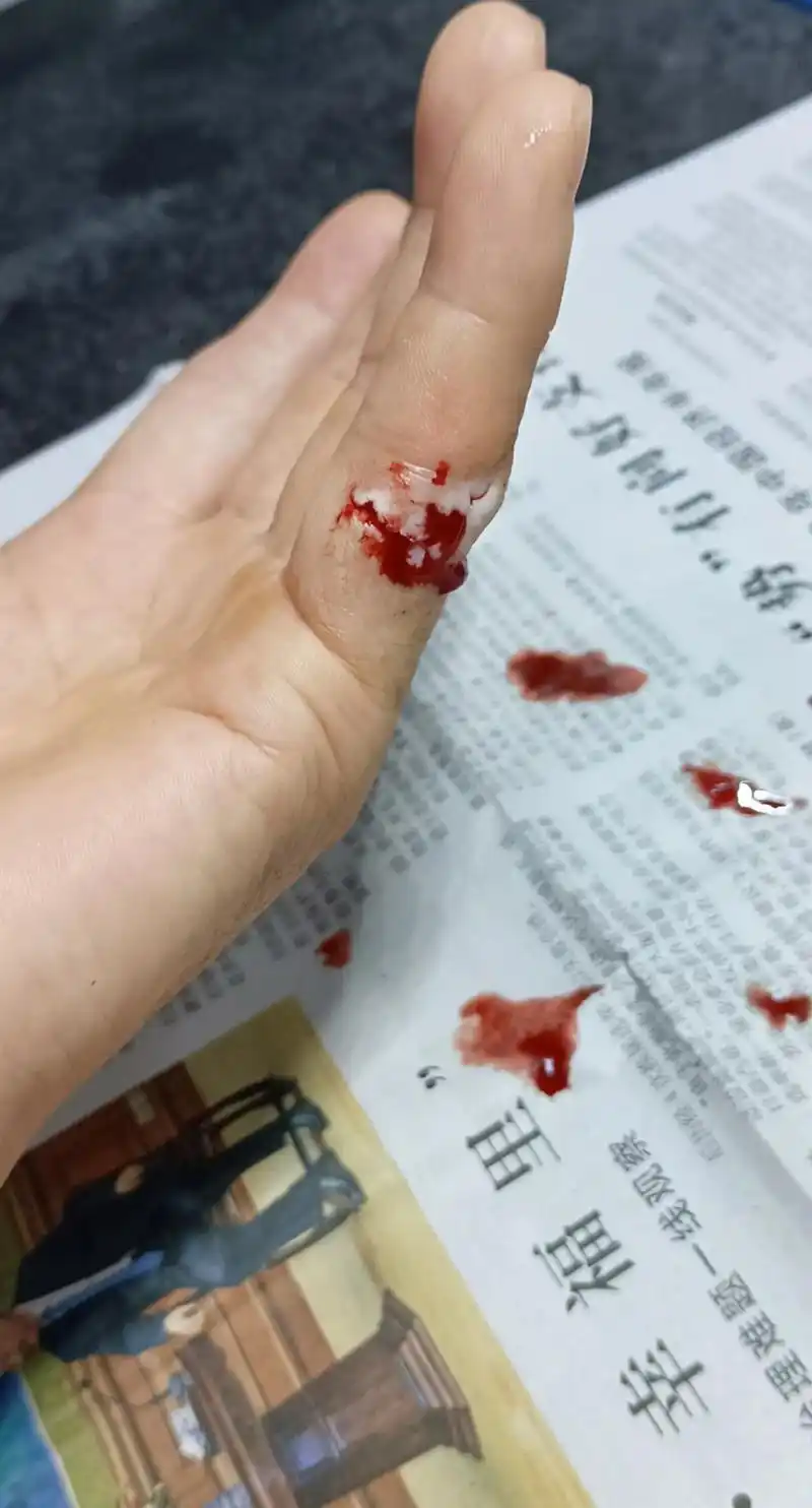 一不小心手受伤了,没有任何责怪的理由,只怪自己不小心,看着血 - 抖音