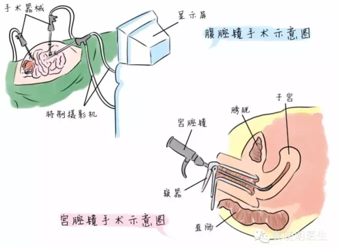 究竟为什么怀不上孩子