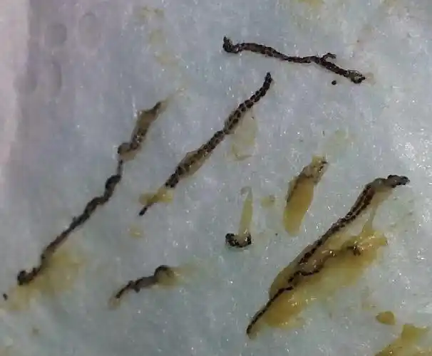 幼儿大便里有黑色长条又是一节一节的是什么寄生虫