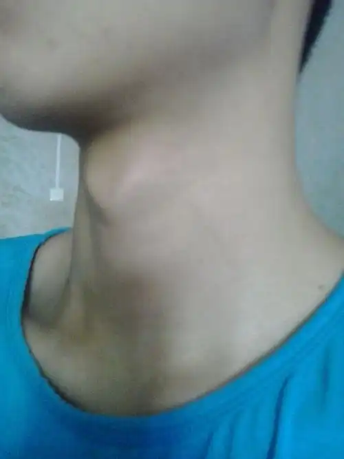 这喉结大吗?----------------这个跟雄性激素有关系吗?