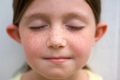 面部美容提升针一疗程8次有效改善面部暗黄松弛双下巴