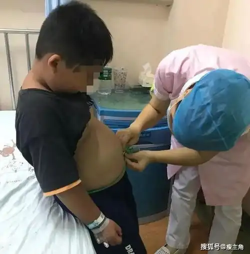 的严重性,平时看上去活泼可爱的亮亮,因为肥胖,不仅小丁丁发育不良