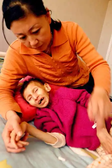 12岁女孩得怪病 长相如同六旬老太 - 休闲娱乐 - 综合社区 - 同花顺