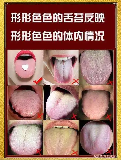 注意!如果宝宝的舌苔不正常怎么治疗?