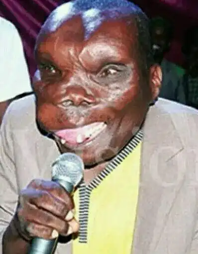 世上最丑的男人胆小勿看