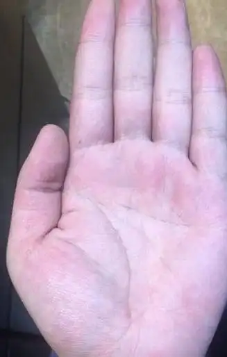 手掌中元宝(手掌中元宝里还有个三角纹好不好)