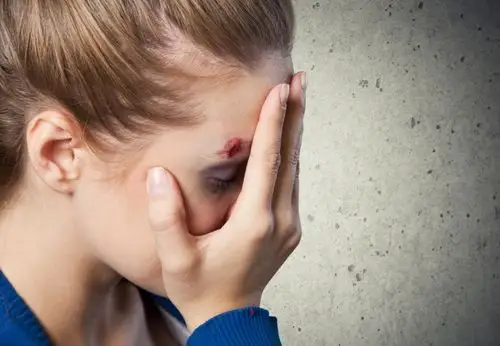 天空下受伤难过的女孩图片素材-女孩受伤难过创意图片素材-jpg图片