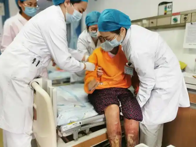 13岁少女双下肢严重溃烂险截肢,儿科医护妙手治愈