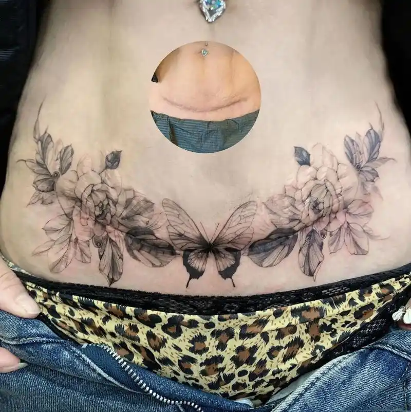 我的所有都是我的美丽.03腹部疤痕遮盖#纹身 #tattoo - 抖音