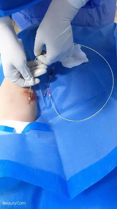 桃江县中医医院急诊科之picc置管术篇