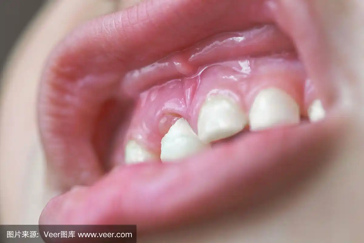 乳牙,脱落的牙齿的特写微距镜头