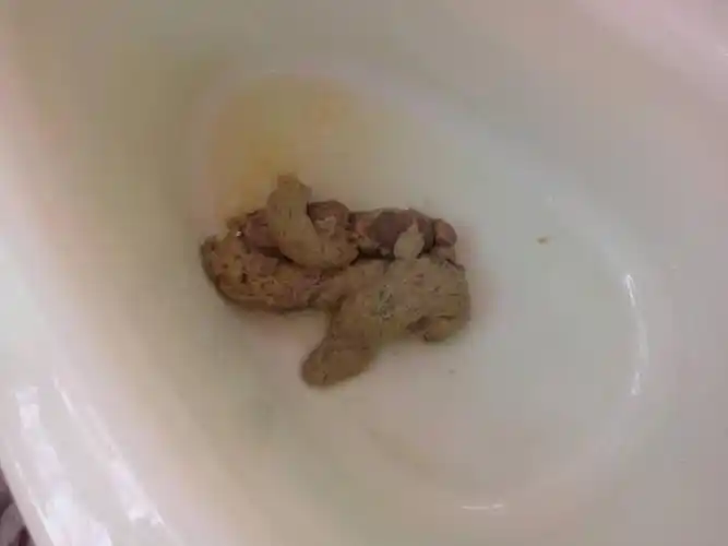 奶粉喂养!不知道这大便正常吗?