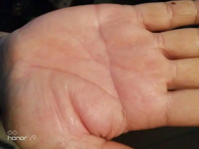 手上的这道横纹代表什么?谢谢