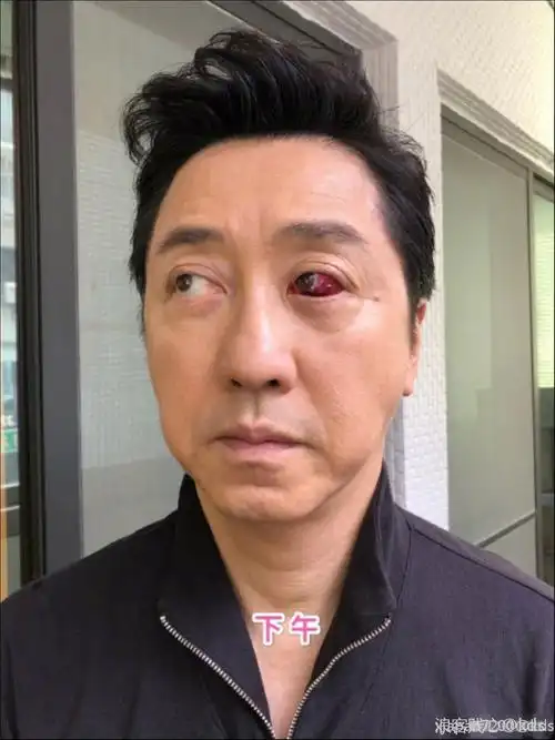 相亲女是斗鸡眼怎么办