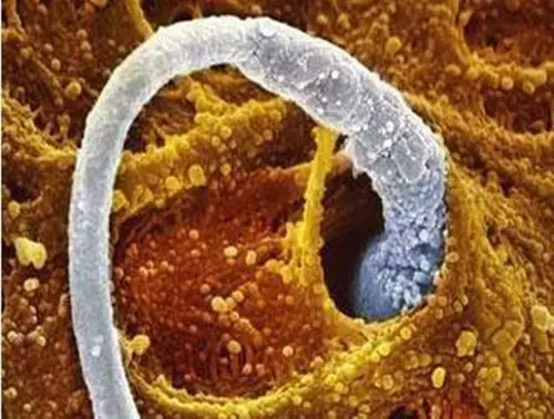 备孕女性需知小常识:卵子排出时是什么感觉?_排卵