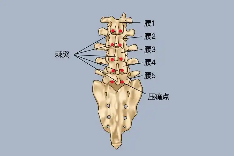腰突痛点位置图