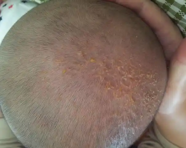 宝宝润肤油的用途:软化头垢,按摩皮肤,宝妈们可别用错地方!